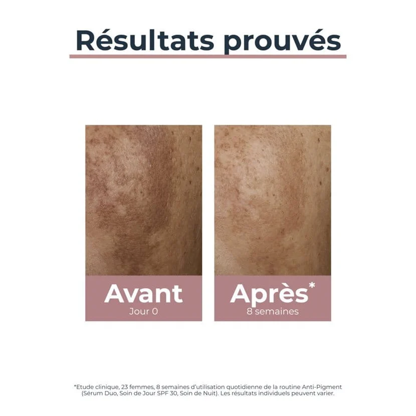 EUCERIN ANTI PIGMENT SOIN JOUR SPF30 50M – Image 3