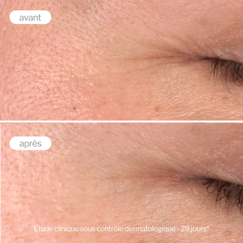 NOVEXPERT COFFRET SERUM BOOSTER PRO COLLAGENEE+MINI BOOSTER VITAMINE C – Image 4