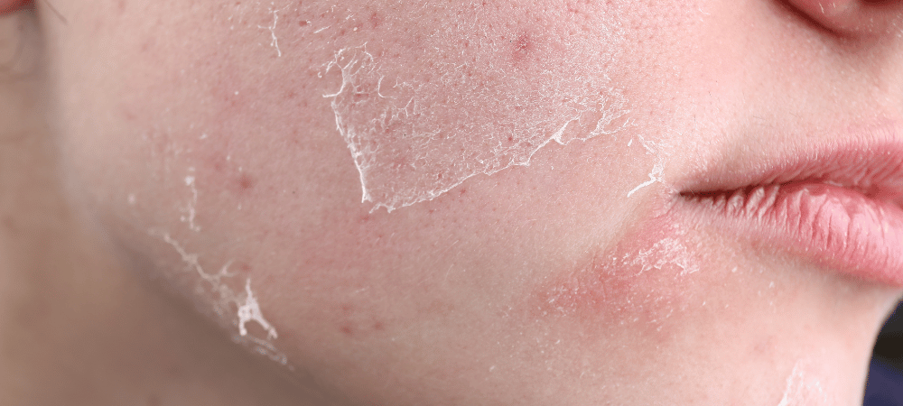 BEBE ET MAMAN PARAPHARMACIE PARAPHARMACIE EN LIGNE PARAPHARMACIE MAROC PARAPHARMACIE EN LIGNE MAROC